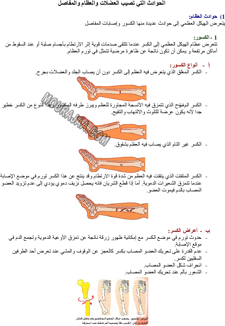 الحوادث التي تصيب العضلات والعظام والمفاصل