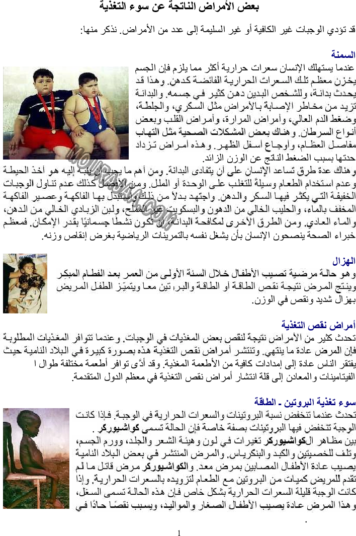 بعض الأمراض الناتجة عن سوء التغذية