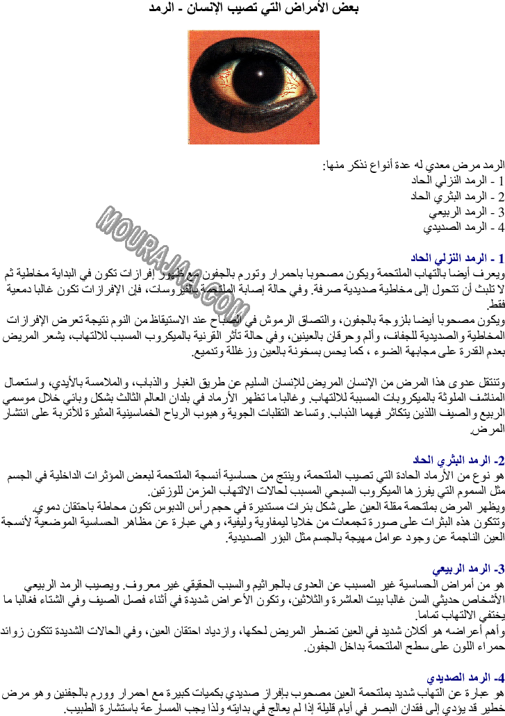  بعض الأمراض التي تصيب الإنسان - الرمد