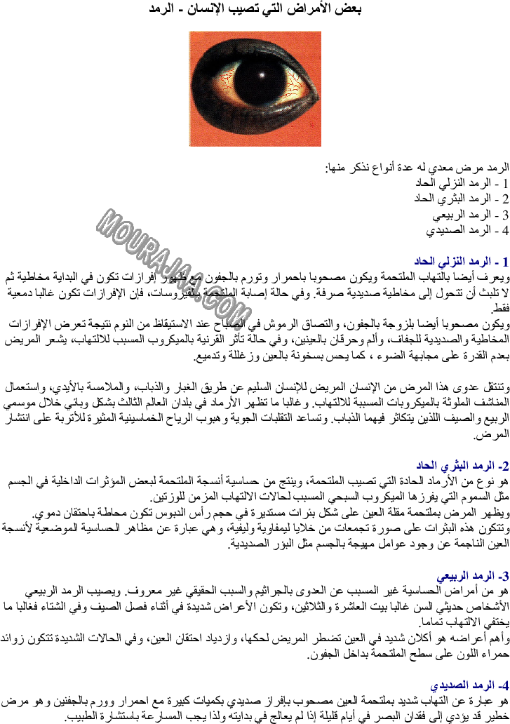 بعض الأمراض التي تصيب الإنسان - الرمد